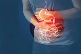 Gastrointestinal Issues