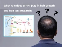 SFRP1 چه نقشی در تحقیقات رشد مو و ریزش مو دارد