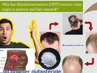 چرا DHT به یک هدف کلیدی در تحقیقات پروستات و مو تبدیل شده است؟